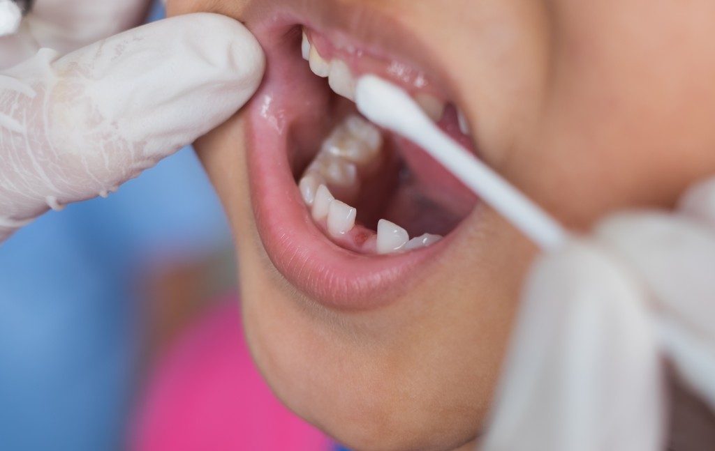 Children boy receive fluoride medicine and dental examination in the mouth by a dentist