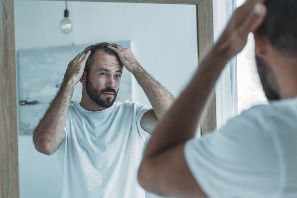 man suffering from hair loss