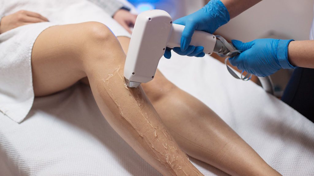 Woman getting a laser hair removal on her legs