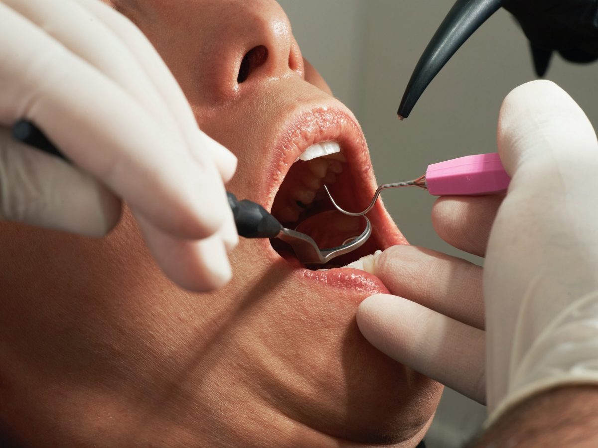a dental checkup